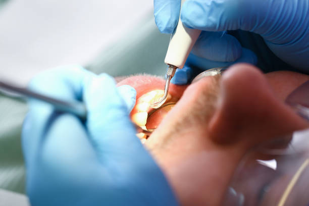 Best Emergency Dental Care for Broken or Chipped Teeth in Montz, LA