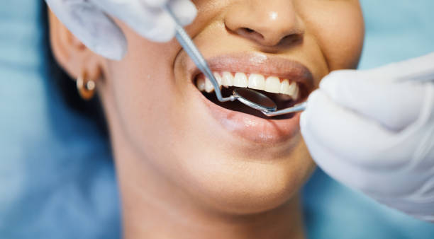 Best Same-Day Emergency Dental Services in Montz, LA