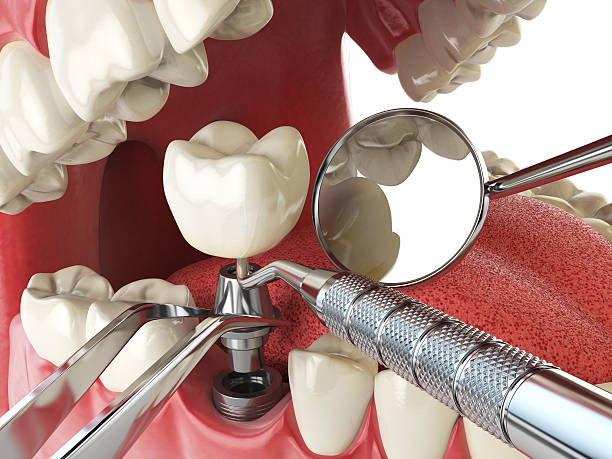 Best After-Hours Dental Trauma Care in Montz, LA